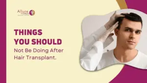 Things You Should Not Be Doing After Hair Transplant.