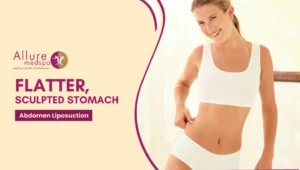 Abdomen Liposuction 300x170 1