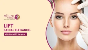 Brow Lift Surgery 300x170 1