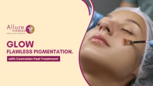 Cosmelan Treatment 300x170 1