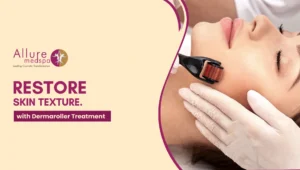 Dermaroller Treatment 300x170 1