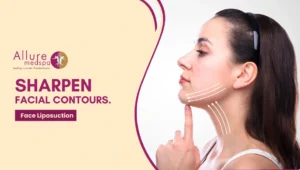 Face Liposuction 300x170 1