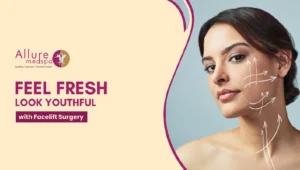 Face lift surgery 300x170 1