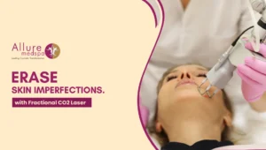 Fractional CO2 Laser 300x170 1