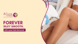 Laser Hair Removal 300x170 1