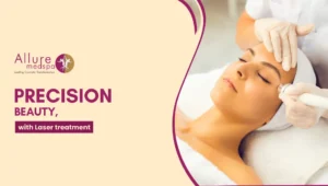 Laser treatment 300x170 1