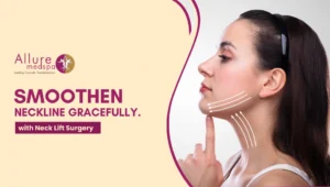 Neck Lift Surgery 300x170 1