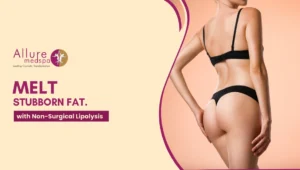 Non Surgical Lipolysis 300x170 1