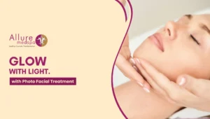 Photo Facial Treatment 300x170 1