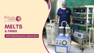 Radiofrequency Liposuction 300x170 1