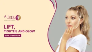 Thread lift1 300x170 1