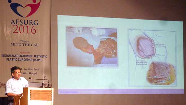 AESURG Conference Pics 2016