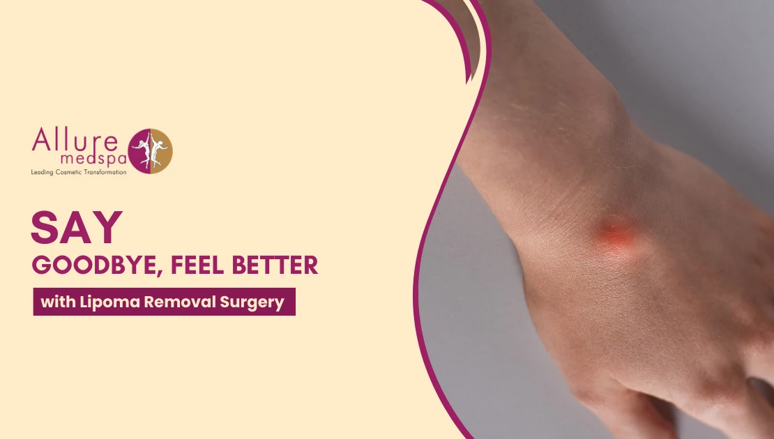 Lipoma Removal surgery