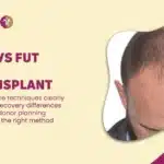 FUE vs FUT HAIR TRANSPLANT in Mumbai, India