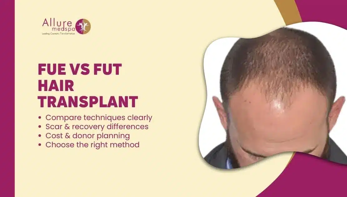 FUE vs FUT HAIR TRANSPLANT in Mumbai, India