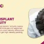 Hair Transplant Density in mumbai india