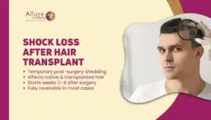 SHOCK LOSS AFTER HAIR TRANSPLANT in Mumbai, India