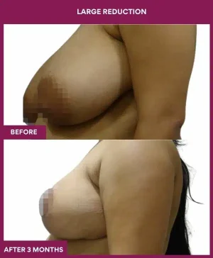 1 large Reduction (2)