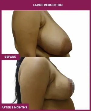 1 large Reduction (3)