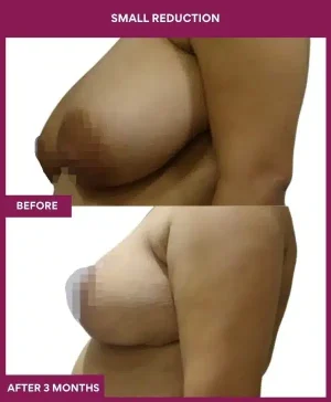 2 small reduction_106_ (2)