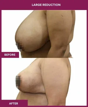 3 large Reduction (2)