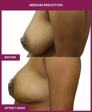 3 medium reduction (3)