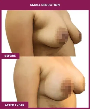 3 small reduction (2)_107_