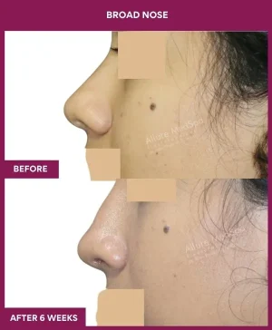 4 BROAD NOSE_12_ (2)