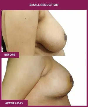 4 small reduction (2)