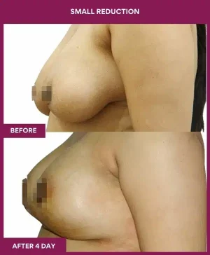 4 small reduction (3)