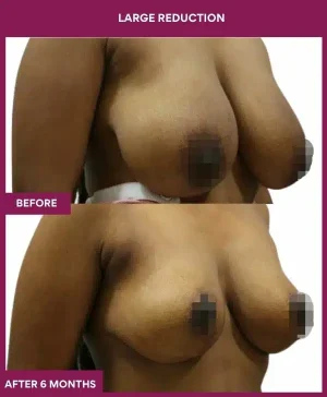 5 large Reduction (3)