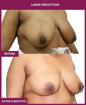 7 large Reduction (2)