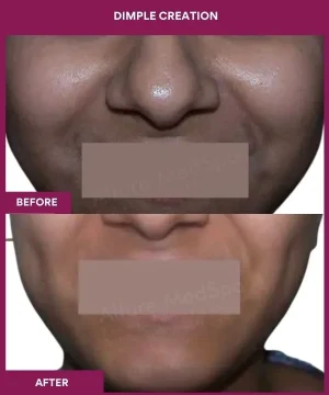 Dimple Creation in Mumbai