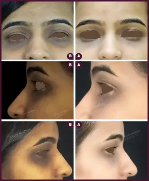 Allure_Sweta_Dark_circle_2021-3